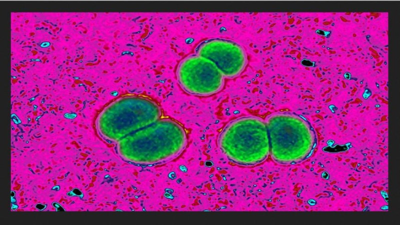 Mimořádná a znepokojivá zpráva z Ruska: migranti a smrtelný meningokok